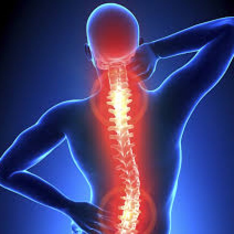 Physiotherapy for Back Pain Sydney